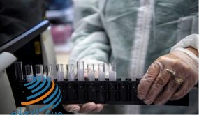 ابتكار أول آله حاسبة تحذر الأشخاص من الإصابة بـ”كورونا”