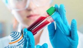 اكتشاف جديد لتطوير علاج أشرس أنواع سرطان الدم