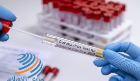 Hands with protective glove, examining a novel coronavirus covid 19 test tube the result is + positive.