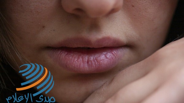علامة خفية للإصابة بـ(كوفيد-19) تظهر على الشفتين