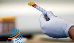 بلجيكا تعلن 20 سبتمبر موعدا لبدء استخدام تطبيق تعقب المصابين بكورونا