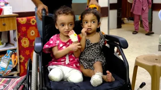 15 ألف مبتور أطرافهم واحتياجات طبية عاجلة في غزة