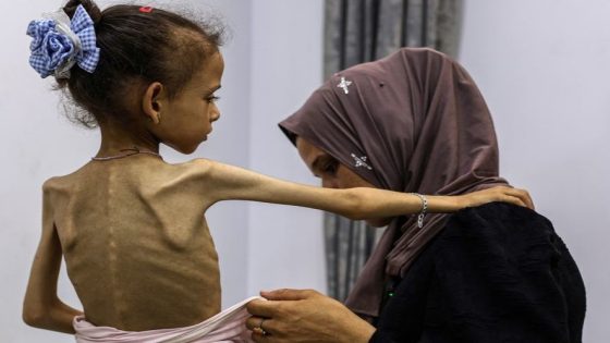 “اليونيسيف” تحث على تدفق المساعدات لغزة وتحذر من ارتفاع وفيات الأطفال