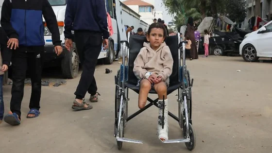 6 آلاف مبتور في غزة.. دعوة دولية عاجلة لإعادة التأهيل والدعم النفسي