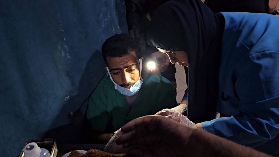 Medical workers treat a Palestinian injured in an Israeli strike, using flashlights due to the power cut at the Indonesian Hospital in the northern Gaza Strip, November 10, 2023. REUTERS/Anas al-Shareef