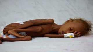 الأطفال