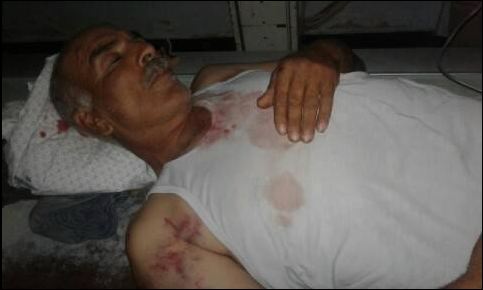 صور – المسن عبدالرحمن بركة تعرض للتنكيل به في غزة ..لماذا؟